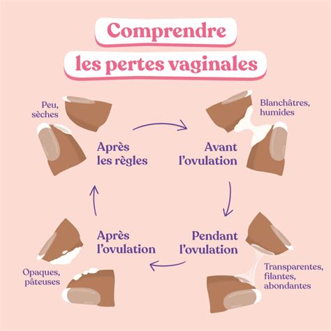 Pertes vaginales blanches et crémeuses : causes et traitement